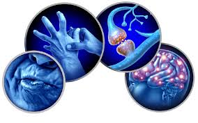 Movement Disorders Treatment